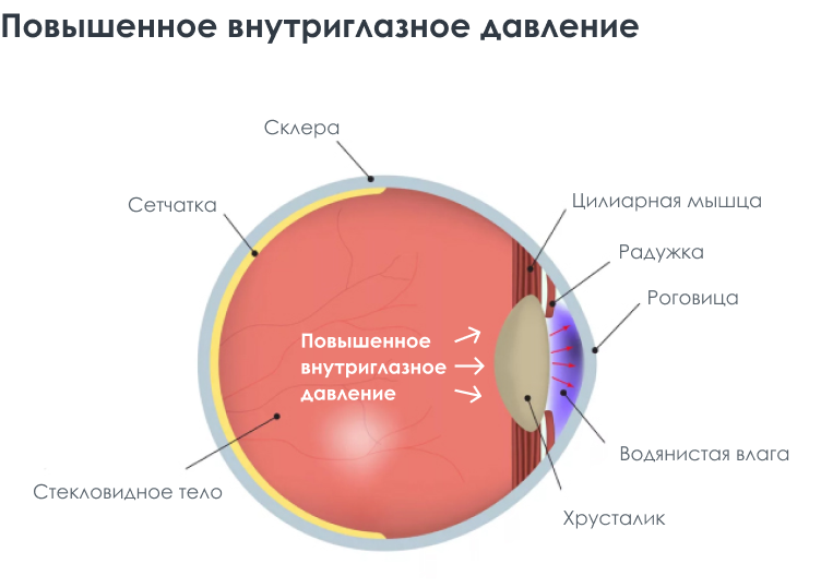 Внутриглазное давление (ВГД)